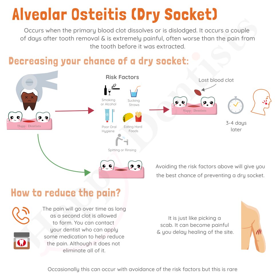 What Is Dry Socket Condition After Tooth Extraction, Dentist
