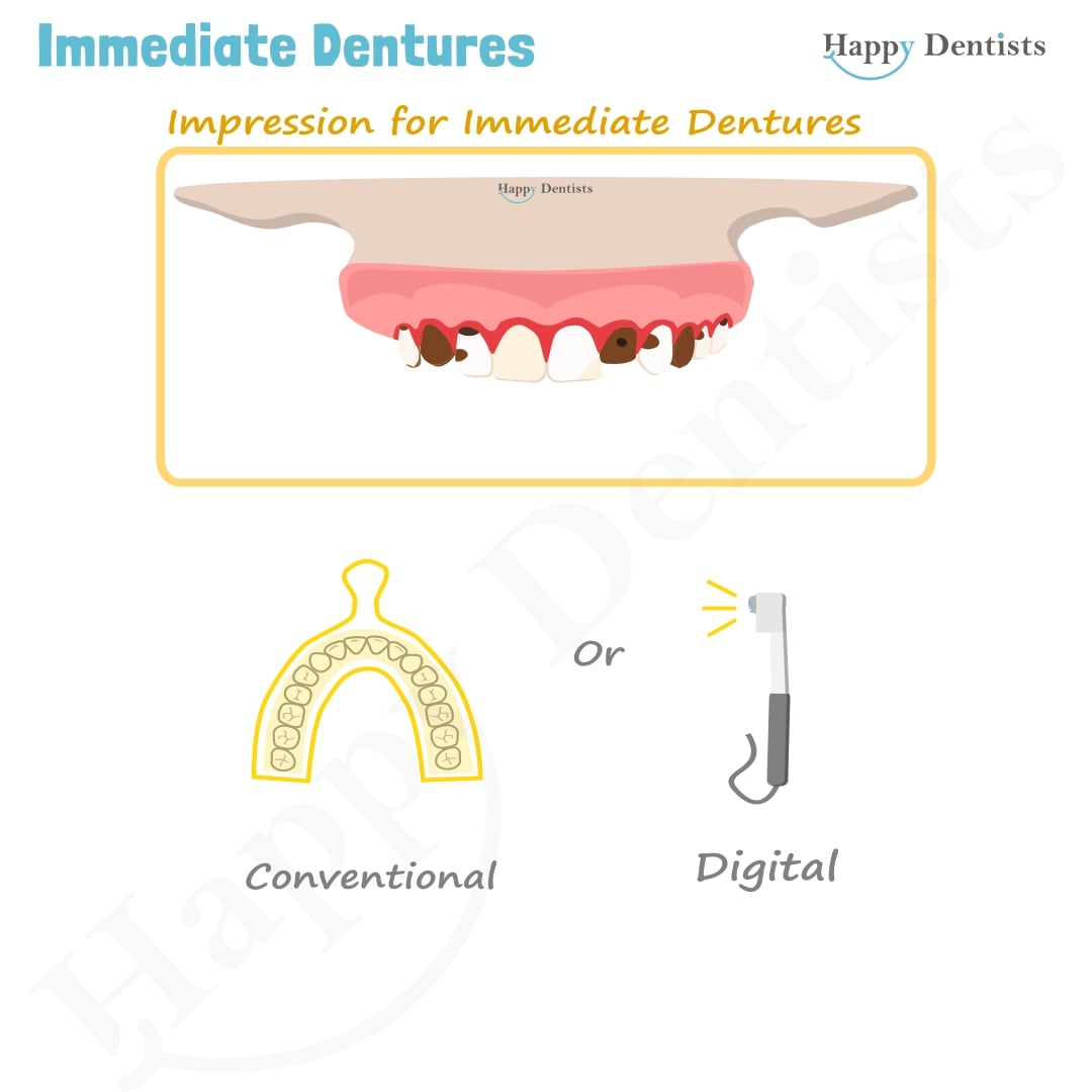 Immediate Dentures, Denture Animation