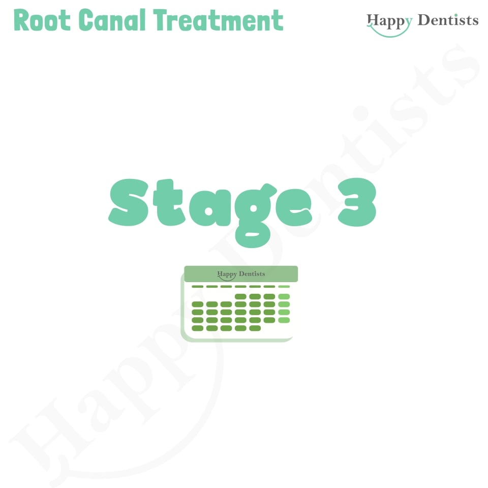 Root Canal Treatment Stages Animation, What is a Root Canal, Root canal treatment?, What is Root Canal treatment?